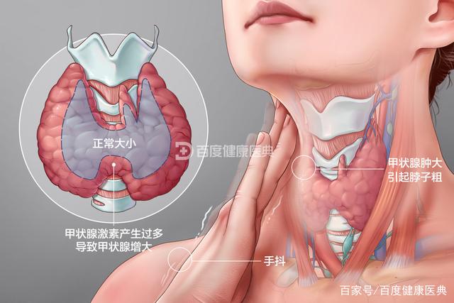 認識甲狀腺疾病的古今